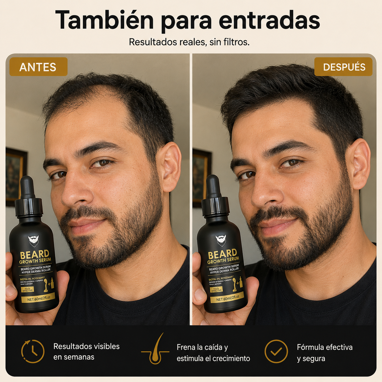 Barba con huecos, rala o dispareja: el sistema que la vuelve más llena y poblada