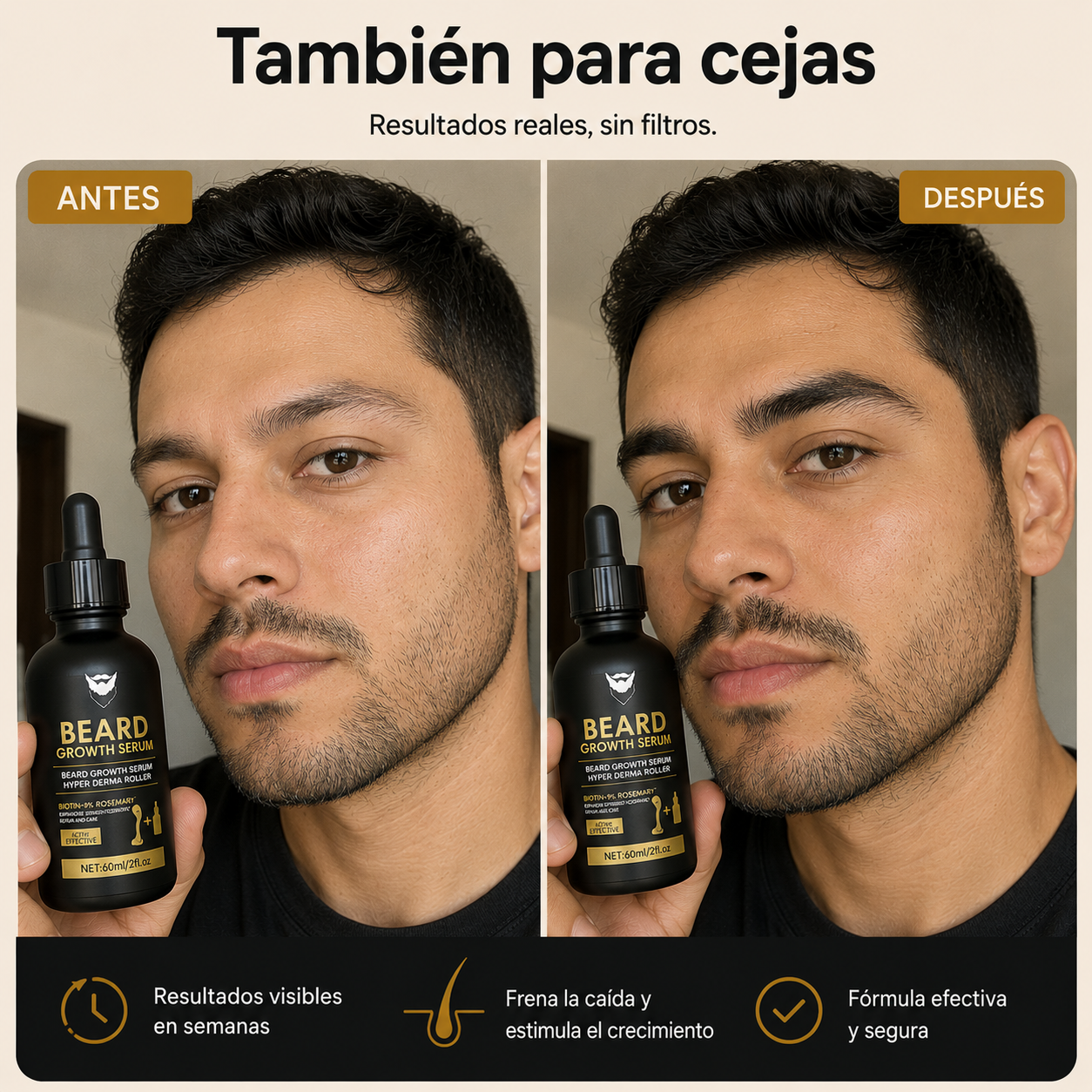 Barba con huecos, rala o dispareja: el sistema que la vuelve más llena y poblada