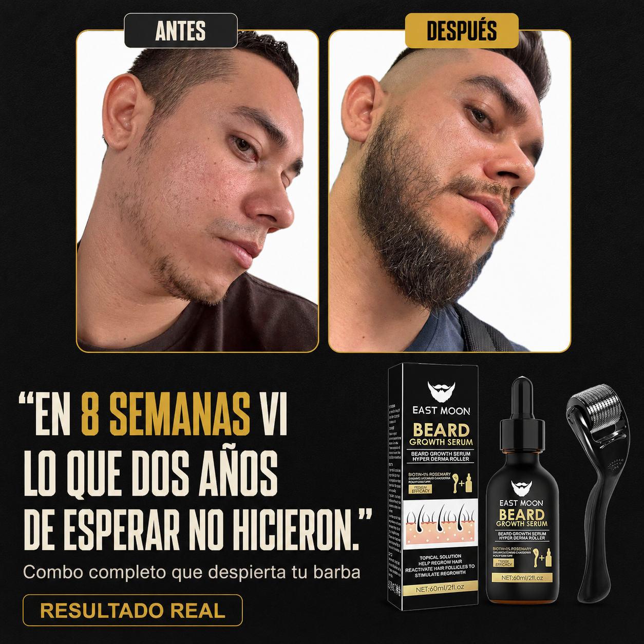Kit Barba Completa — Sérum + Derma Roller